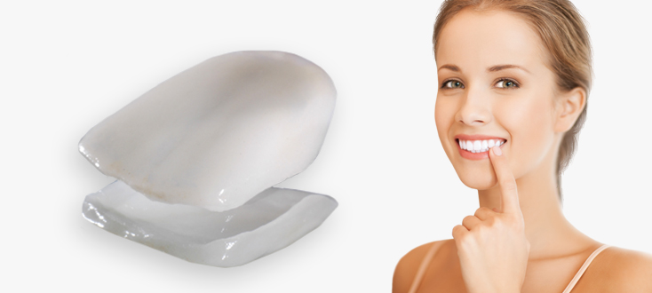 فينير الاسنان اي ماكس EMAX VENEER
