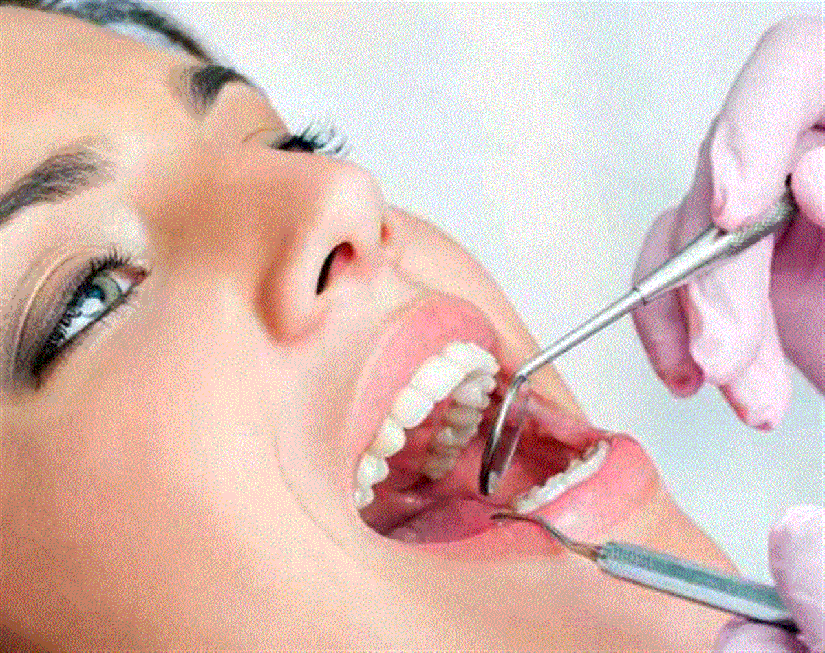 دكتورة توريد لثة اسنان الشارقة عجمان دبي الامارات