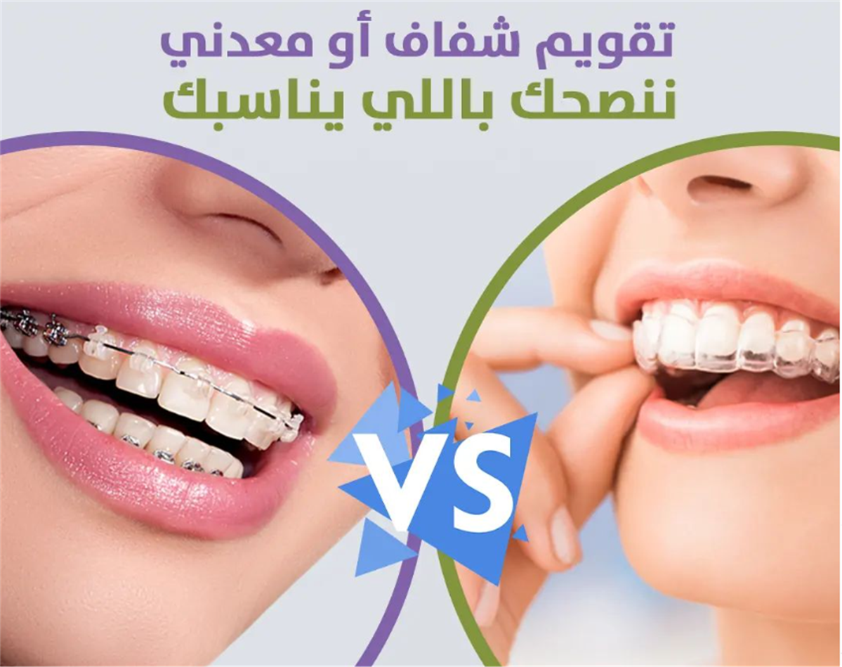 Braces Orchid clinic in Sharjah
