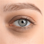 Undereye filler for treating dark circles Orchid clinic in Sharjah