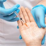 Botox for sweaty hands Orchid clinic in Sharjah
