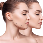 Double chin treatment in Orchid clinic Sharjah