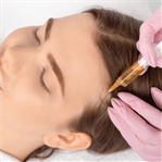 PRP plasma injection for hair orchid clinic in Sharjah